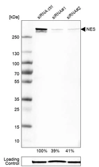 Western blot analysis in U-251MG cells transfected with control siRNA, target specific siRNA probe #1 and #2, using Anti-NES antibody. Remaining relative intensity is presented. Loading control: Anti-GAPDH.
