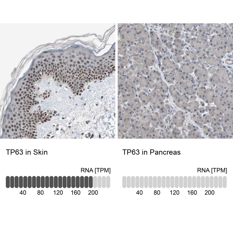Anti-TP63 Antibody