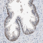 Immunohistochemical staining of human prostate shows weak nuclear positivity in basal layer of glandular cells.