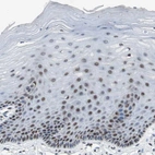 Immunohistochemical staining of human cervix, uterine shows moderate nuclear positivity in squamous epithelial cells.