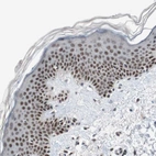 Immunohistochemical staining of human skin shows strong nuclear positivity in keratinocytes.