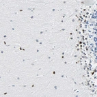 Anti-ZNF131 Antibody