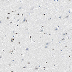 Immunohistochemical staining of human cerebral cortex shows strong nuclear positivity in glial cells.