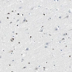 Immunohistochemical staining of human cerebral cortex shows strong nuclear positivity in glial cells.