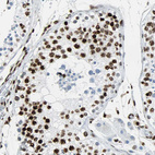 Immunohistochemical staining of human testis shows strong nuclear positivity in cells in seminiferous ducts.