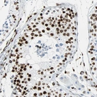Immunohistochemical staining of human testis shows strong nuclear positivity in cells in seminiferous ducts.