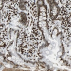 Immunohistochemical staining of human small intestine shows strong nuclear positivity in glandular and stromal cells.