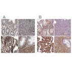 Anti-COL6A2 Antibody