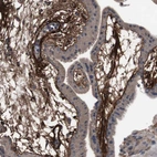 Immunohistochemical staining of human placenta shows strong positivity in extracellular matrix in chorionic vlli.