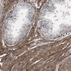 Immunohistochemical staining of human prostate shows moderate to strong membranous and cytoplasmic positivity in smooth muscle cells.