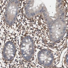 Immunohistochemical staining of human colon shows strong positivity in extracellular matrix in lamina propria.
