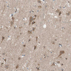 Anti-ADAP1 Antibody
