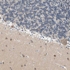 Immunohistochemical staining of human Cerebellum shows moderate cytoplasmic positivity in Purkinje cells.