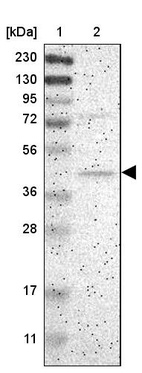 Lane 1: Marker [kDa] 230, 130, 95, 72, 56, 36, 28, 17, 11_br/_Lane 2: Human cell line RT-4