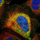 Immunofluorescent staining of human cell line A-431 shows localization to plasma membrane & cytosol.