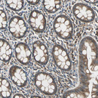 Immunohistochemical staining of human rectum shows moderate cytoplasmic positivity in glandular cells.