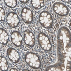 Immunohistochemical staining of human rectum shows moderate cytoplasmic positivity in glandular cells.