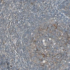 Immunohistochemical staining of human tonsil shows moderate cytoplasmic positivity in germinal center cells.