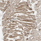 Immunohistochemical staining of human heart muscle shows moderate cytoplasmic positivity in cardiomyocytes.