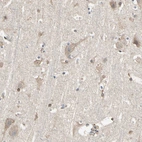 Immunohistochemical staining of human cerebral cortex shows weak cytoplasmic positivity in neurons.
