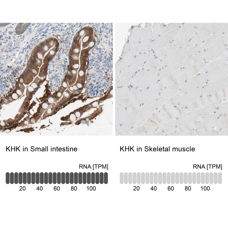 Anti-KHK Antibody