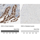 Anti-KHK Antibody