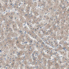 Immunohistochemical staining of human liver shows moderate cytoplasmic positivity in hepatocytes.
