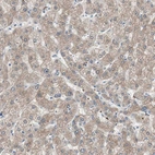 Immunohistochemical staining of human liver shows moderate cytoplasmic positivity in hepatocytes.