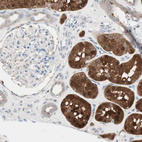 Immunohistochemical staining of human kidney shows moderate cytoplasmic positivity in cells in tubules.