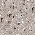 Anti-ACVRL1 Antibody