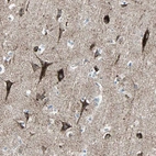Anti-ACVRL1 Antibody
