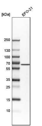 Western blot analysis in human cell line EFO-21.