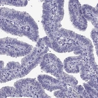 Immunohistochemical staining of human fallopian tube shows no positivity in glandular cells as expected.