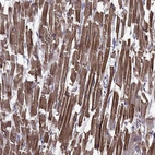 Immunohistochemical staining of human heart muscle shows strong cytoplasmic positivity in cardiomyocytes.