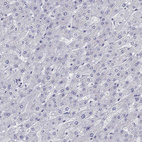 Immunohistochemical staining of human liver shows no positivity in hepatocytes as expected.