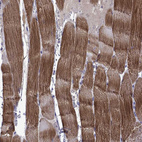 Immunohistochemical staining of human skeletal muscle shows strong cytoplasmic positivity in myocytes.