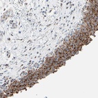 Anti-HK1 Antibody