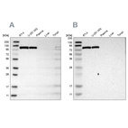 Western blot analysis using Anti-HK1 antibody HPA007043 (A) shows similar pattern to independent antibody HPA007044 (B).