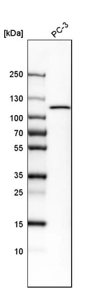 Western blot analysis in human cell line PC-3.