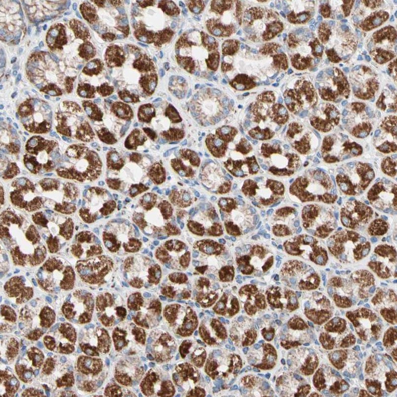 Anti-HK1 Antibody