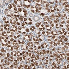 Anti-HK1 Antibody