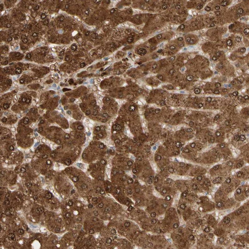 Anti-GNE Antibody