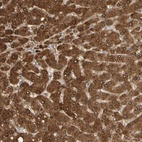Anti-GNE Antibody