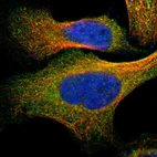Immunofluorescent staining of human cell line U-2 OS shows localization to cytosol.