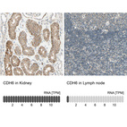 Anti-CDH6 Antibody