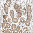 Anti-CDH6 Antibody