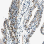 Immunohistochemical staining of human fallopian tube shows strong membranous positivity in glandular cells.