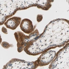 Immunohistochemical staining of human placenta shows strong cytoplasmic positivity in trophoblastic cells.