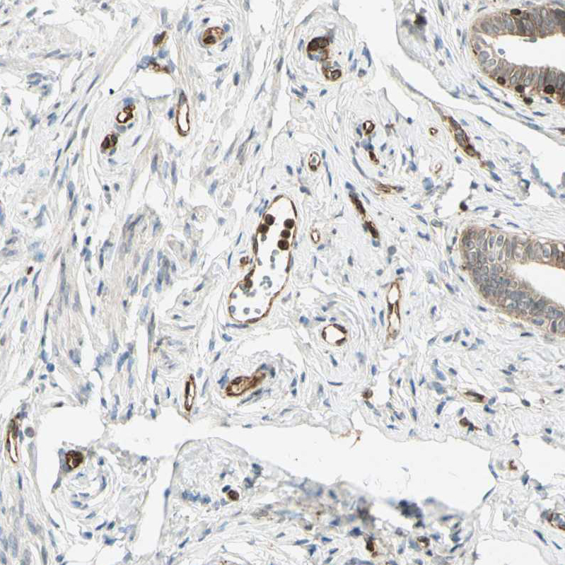 Anti-TAPBP Antibody