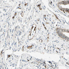 Anti-TAPBP Antibody
